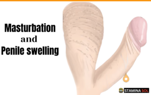 Read more about the article Penile Swelling After Masturbation: Causes, Risks, and Quick Relief